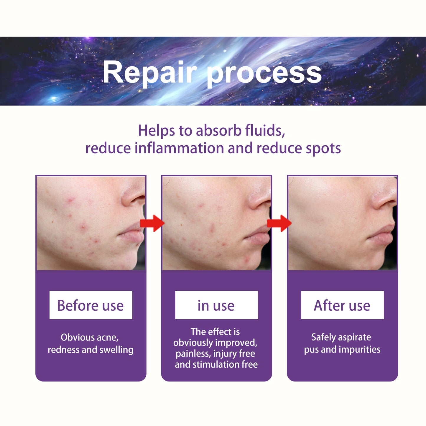 Breathable Repair Acne Skin Pattern Acne Patch