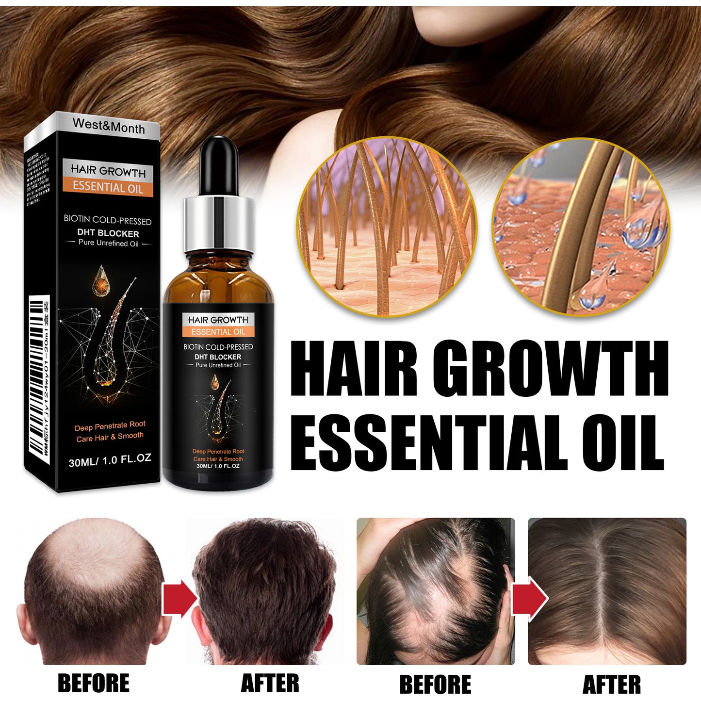 Hair Care Oils