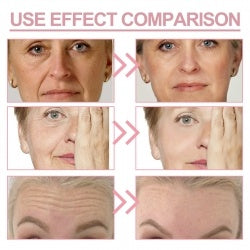 Jaysuing Wrinkle Bounce Multi Balm Hydrating Moist Skin Fade Out Fine Neck Lines Of The Face Bright Skin
