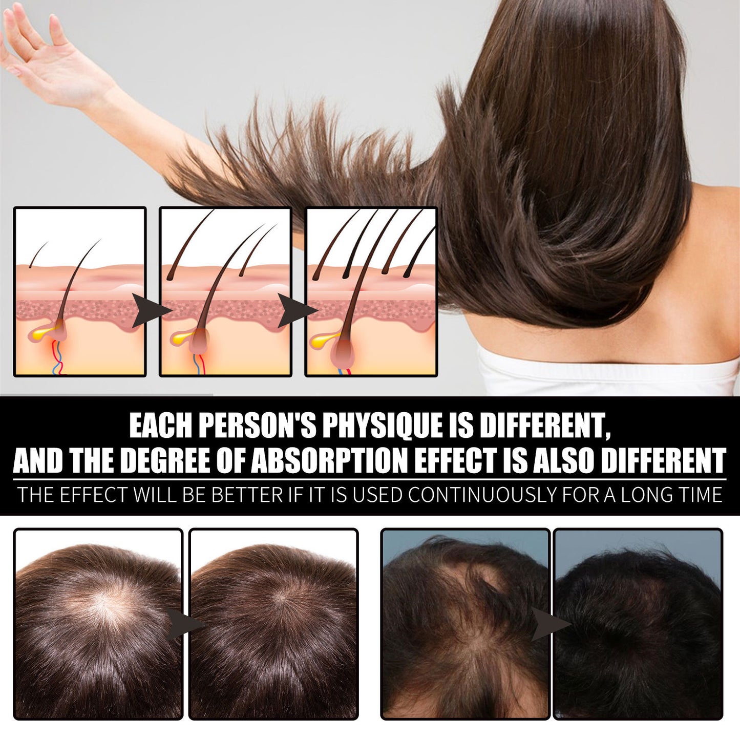 RESEARCH Liquid Biotin & Collagen Hair Growth Drops - Biotin And Liquid Collagen Supplement For Men & Women - Glowing Skin Support, Healthy Hair & Nail Growth