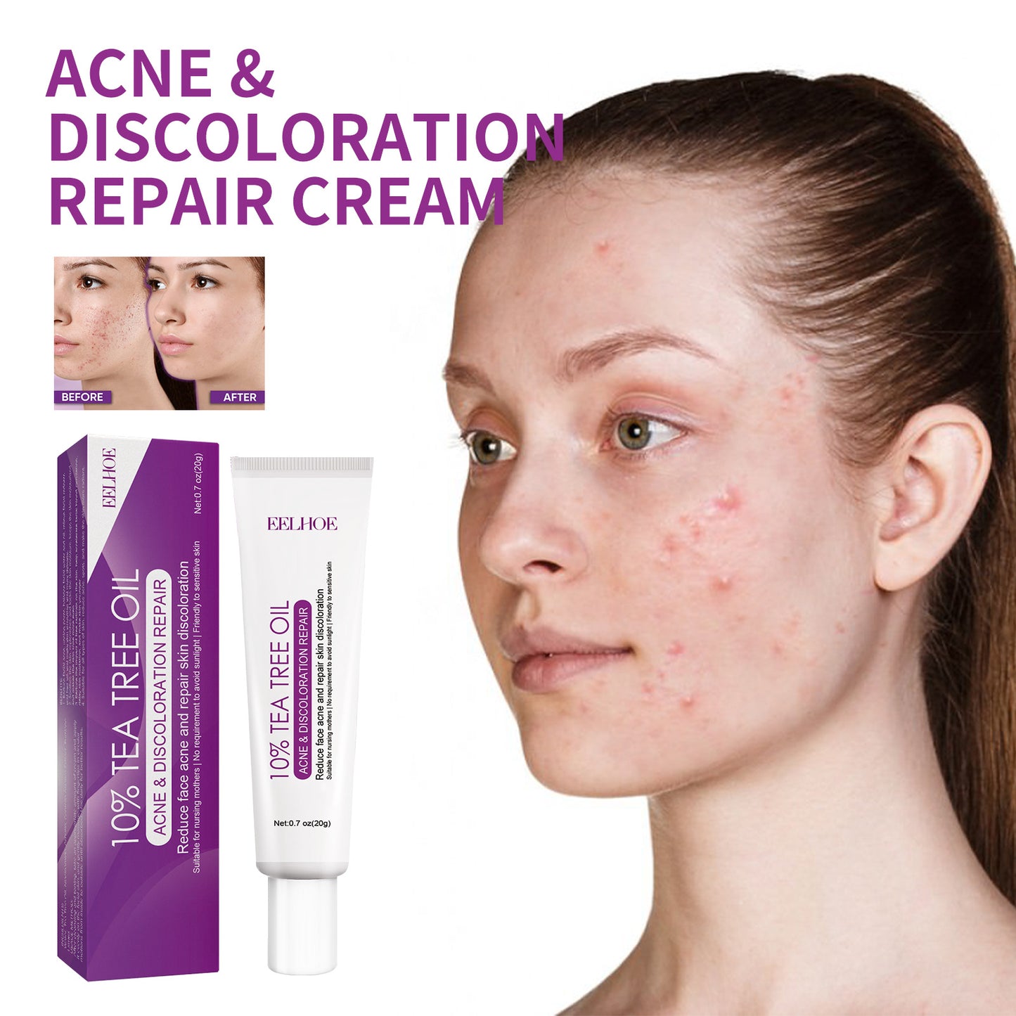 Spot Fading And Whitening Cream