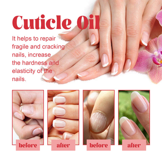 Repairing Hand, Foot And Nail Thickening Care Liquid