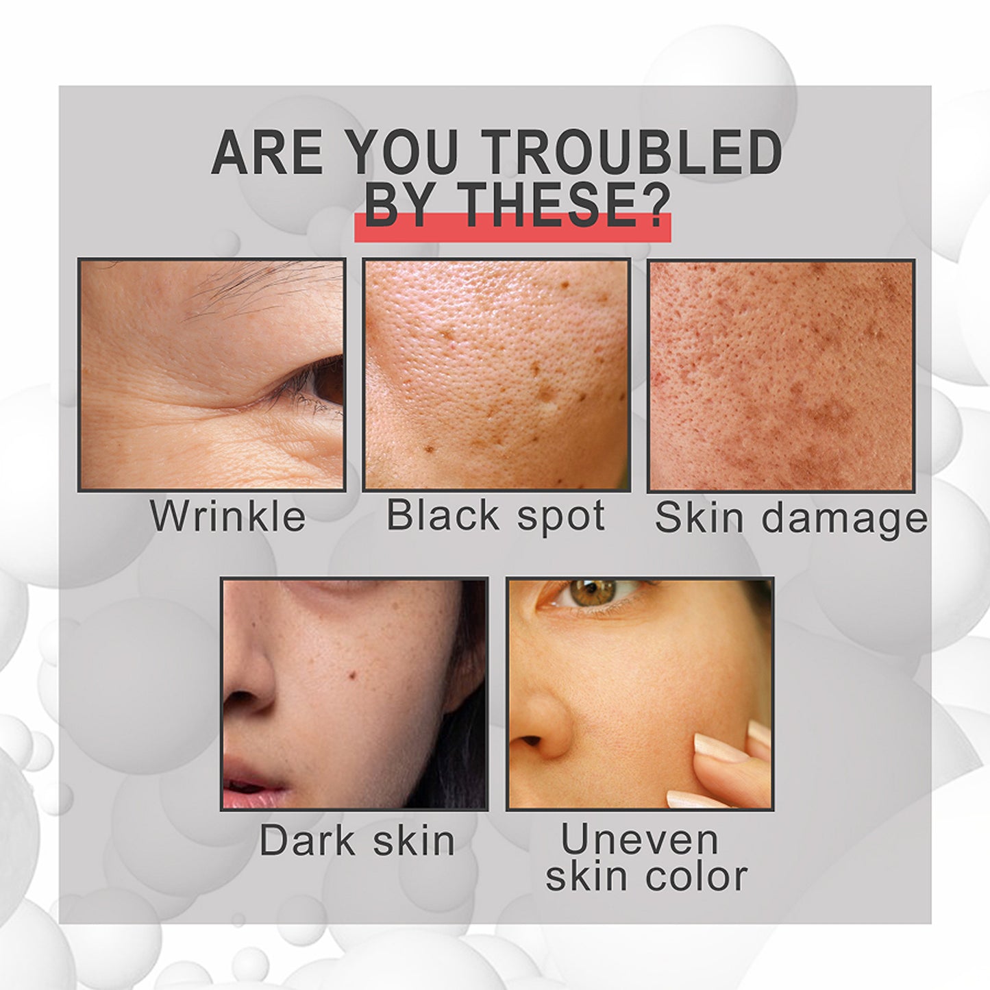 Anti-aging Cream-Fade Fine Lines On The Face, Nasolabial Folds, Repair Firm, Moisturize The Skin, Anti-wrinkle Cream