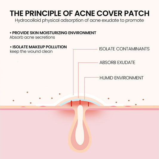 Spotted Acne Scars Cover Acne Patches